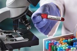 راه‌اندازی آزمایشگاه تشخیص کرونا در پژوهشگاه رویان