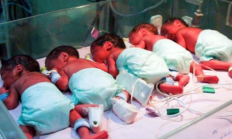 واریز مستمری برای ۶ قلوهای کرجی/ خانوادههای دارای فرزند دوقلو هم مستمری دریافت میکنند
