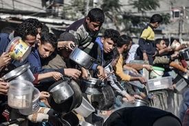 پزشک عمانی: کودکان غزه از شدت گرسنگی سنگ‌ریزه و باتری می‌خورند