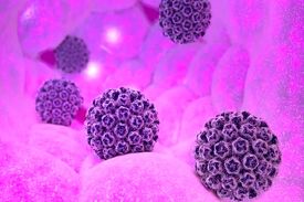 با واکسیناسیون HPV، سونامی سرطان‌ را در نطفه خفه کنید